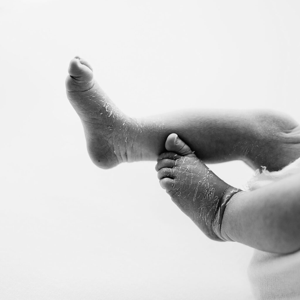 Britta-Passmann-Fotografie-Dortmund-Neugeborenenfotos-Newbornfotos-Babyfotos-Fotoshooting_Fresh48-Shooting_Neugeborenenfotos_im_Krankenhaus